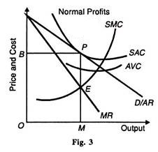 Normal Profits